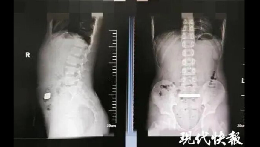 撞脸太乙真人社区主任发声,香港正版资料全年免费公开,决策资料解释落实_网红版V4.69